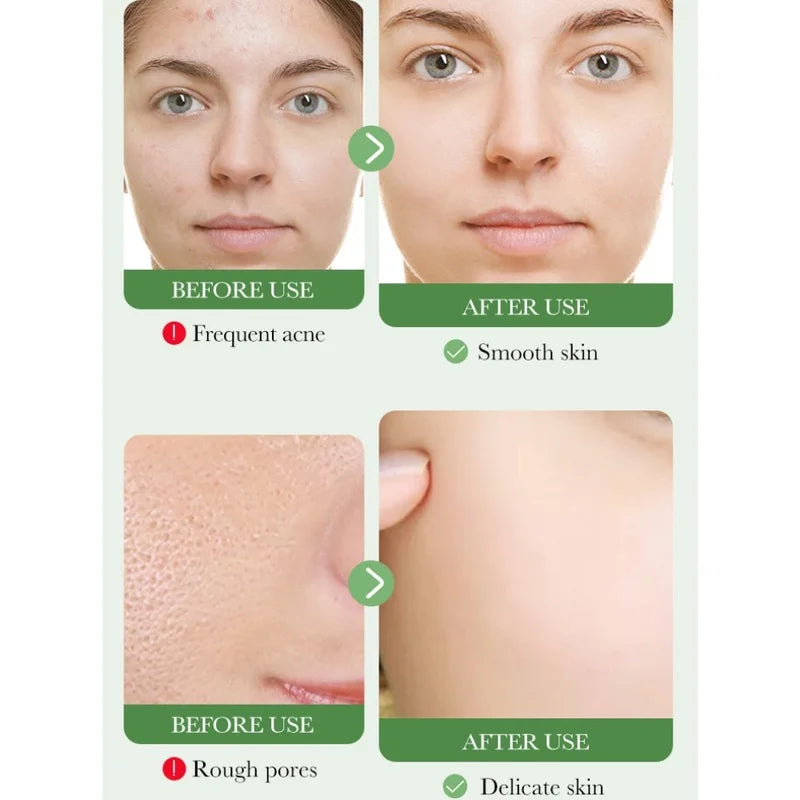 BIOAOUA Nourishing Centella Asiatica Facial Cleanser for Deep Pore Cleansing and Soothing Skin Care 100G